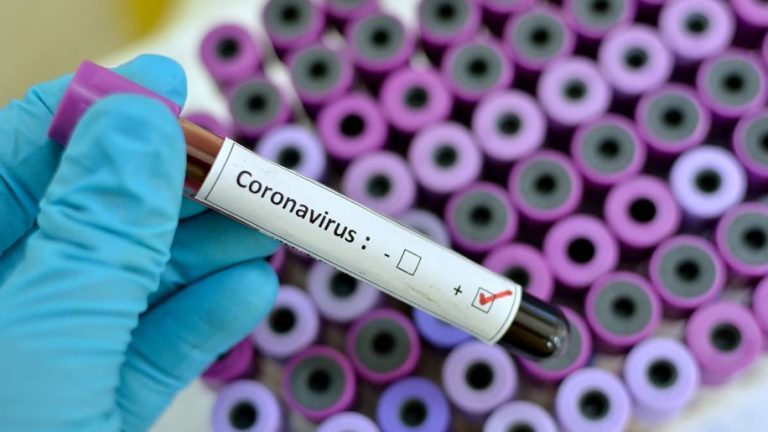 Maharashtra: Three doctors screening in ‘Dharavi’ test positive for coronavirus