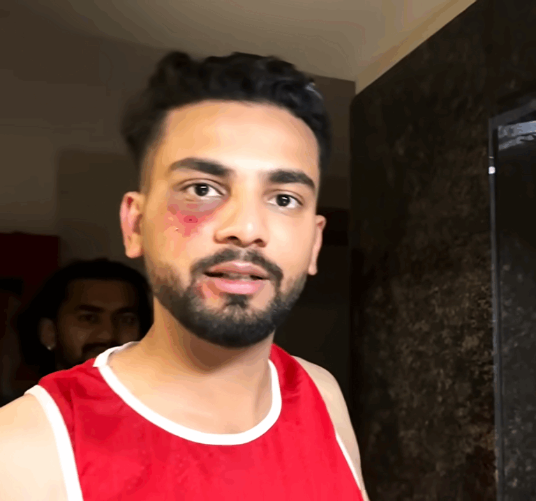 Unknown assailants open fire at Youtuber Elvish Yadav’s home in Gurugram