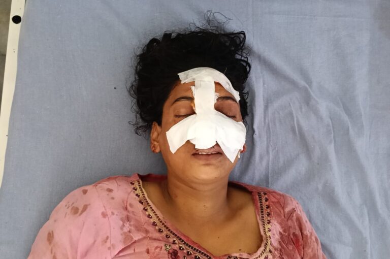 Moradabad: Husband chops wife’s nose off after giving ‘talaq’, now on the run